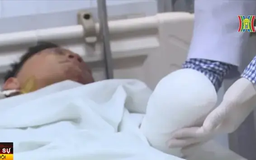 Nhiều tai nạn nghiêm trọng do tự chế pháo nổ