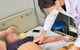 Cụ bà biến dạng khuôn mặt vì dị ứng thuốc nặng