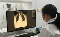 Hà Nội duy trì mạng lưới phòng chống lao