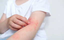 Tăng mạnh ca nhiễm ký sinh trùng từ thú cưng