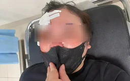 Xác minh vụ tài xế vụt dùi cui vào người đi đường