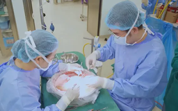 Định kiến hiến tạng người đã khuất