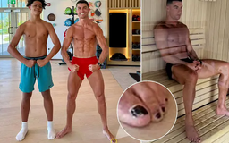 Cristiano Ronaldo sơn móng chân