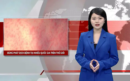 Bùng phát dịch bệnh tại nhiều quốc gia trên thế giới | Nhìn ra thế giới | 02/03/2025