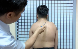 Công nghệ cao trong điều trị bệnh cột sống