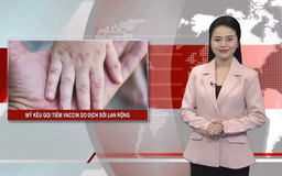 Mỹ kêu gọi tiêm vaccine do dịch sởi lan rộng | Nhìn ra thế giới | 12/04/2025