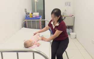 Kéo giãn xương hàm dưới, mở lối thở cho trẻ đa dị tật