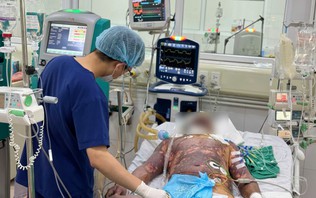 Liên tiếp 4 ca nhiễm liên cầu lợn, có trường hợp suy đa tạng nguy kịch
